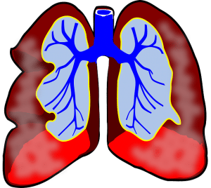 Durch das Inhalationsgerät gelangt der Wirkstoff bis tief in die Lunge